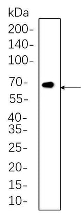 Anti-Human/Mouse/Rat/Pig Smad2, 3 Antibody [B570]