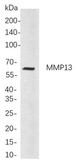 Anti-Human/Mouse MMP13 Antibody [B813]