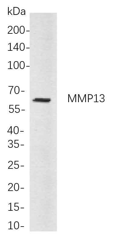Anti-Human/Mouse MMP13 Antibody [B813] - ABMIUM