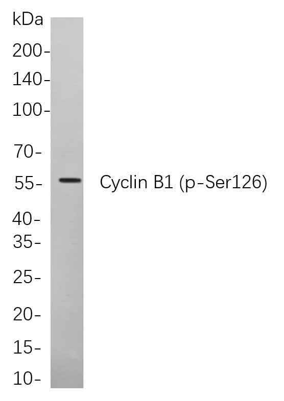 Anti-Human Cyclin B1 Antibody [B738] - ABMIUM