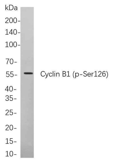 Anti-Human Cyclin B1 Antibody [B738] - ABMIUM