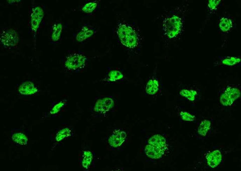 Anti-Human MSH6 Antibody [A1243] - ABMIUM