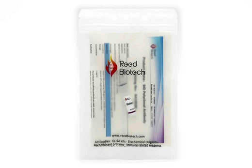 UB2D4 Polyclonal Antibody