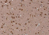 Anti-Human LRPAP1 Antibody [A964] - ABMIUM