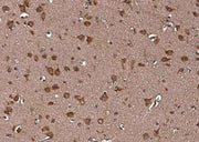 Anti-Human LRPAP1 Antibody [A964] - ABMIUM