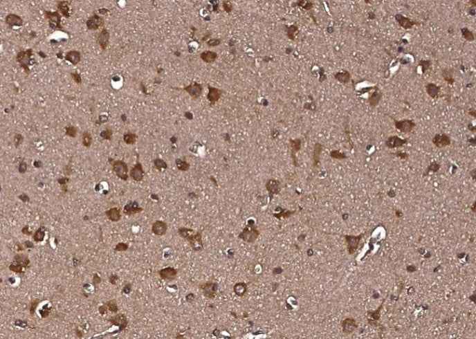 Anti-Human LRPAP1 Antibody [A964] - ABMIUM