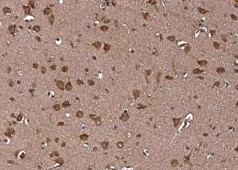 Anti-Human LRPAP1 Antibody [A964] - ABMIUM