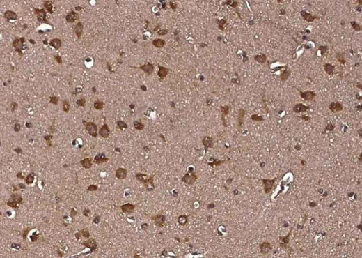 Anti-Human LRPAP1 Antibody [A964] - ABMIUM