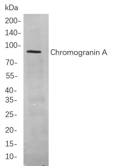 Anti-Human/Mouse/Rat Chromogranin A Antibody [B740] - ABMIUM