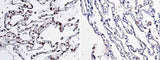 Anti-Human NBL1 Antibody [A943] - ABMIUM