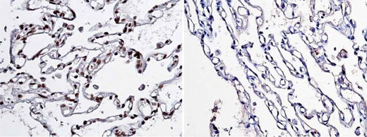 Anti-Human NBL1 Antibody [A943] - ABMIUM