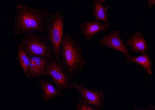 Anti-Human PSPH Antibody [B187] - ABMIUM