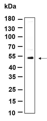 Anti-Human/Mouse/Rat KRTHB3 Antibody [B954]
