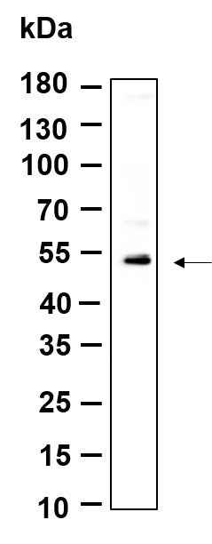 Anti-Human/Mouse/Rat KRTHB3 Antibody [B954] - ABMIUM
