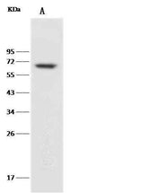 Anti-Human CD27 Antibody [A1116] - ABMIUM