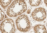 Anti-Human DZIP1 Antibody [A937] - ABMIUM