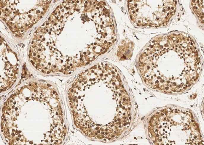 Anti-Human DZIP1 Antibody [A937] - ABMIUM