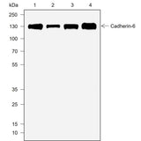 Anti-Human Cadherin-6 Antibody [A728]