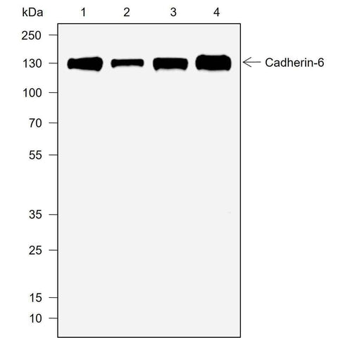 Anti-Human Cadherin-6 Antibody [A728] - ABMIUM