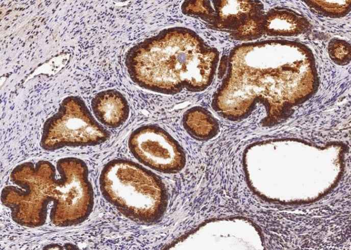 Anti-Human ST6GAL1 Antibody [B153] - ABMIUM