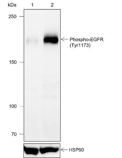 Anti-Human Phospho-EGFR (Tyr1173) Antibody [A825] - ABMIUM