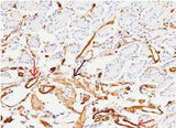 Anti-Human MCAM Antibody [B223]