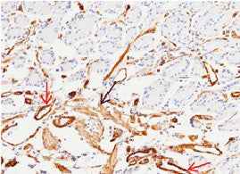 Anti-Human MCAM Antibody [B223] - ABMIUM