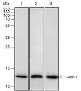 Anti-Human/Rat/Mouse FABP1 Antibody [A489]