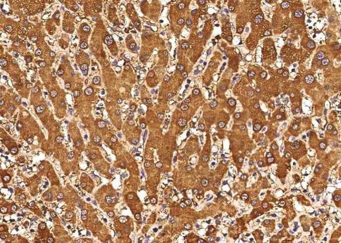 Anti-Human CXCL11 Antibody [A895] - ABMIUM