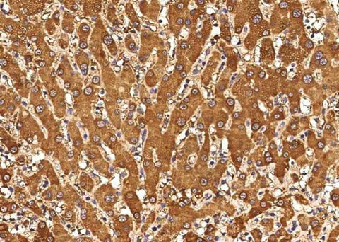 Anti-Human CXCL11 Antibody [A895] - ABMIUM