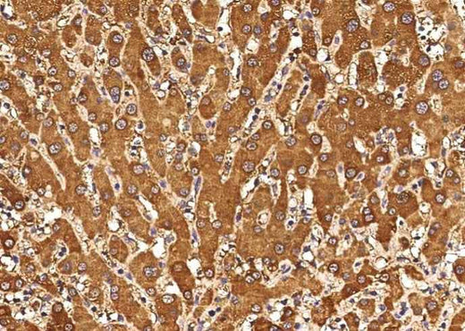 Anti-Human CXCL11 Antibody [A895] - ABMIUM