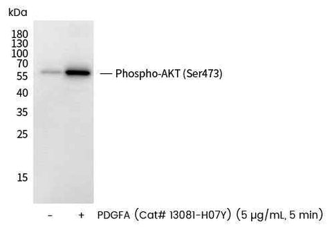 Anti-Human AKT1 Antibody [B302] - ABMIUM