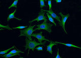 Anti-Human NTRK3 Antibody [A1013] - ABMIUM