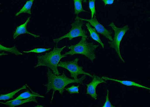Anti-Human NTRK3 Antibody [A1013] - ABMIUM