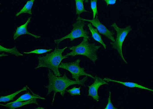 Anti-Human NTRK3 Antibody [A1013] - ABMIUM