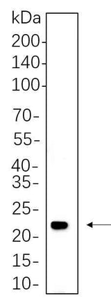 Anti-Human/Mouse/Rat HRAS Antibody [B769]