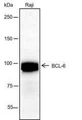 Anti-Human BCL6 Antibody [A139] - ABMIUM