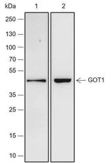 Anti-Human/Rat/Mouse GOT1 Antibody [A236]