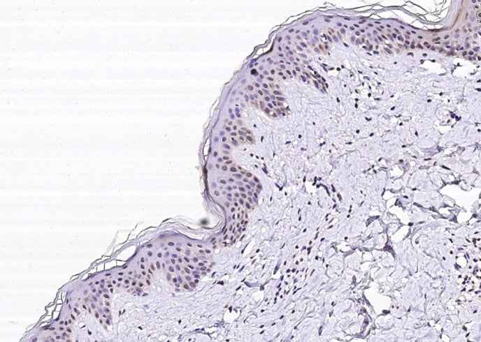 Anti-Human SERPINB4 Antibody [B356] - ABMIUM