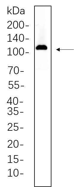 Anti-Human/Mouse/Rat Actinin-α2 Antibody [B531] - ABMIUM