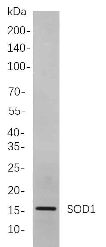 Anti-Human/Mouse/Rat SOD1 Antibody [B836] - ABMIUM