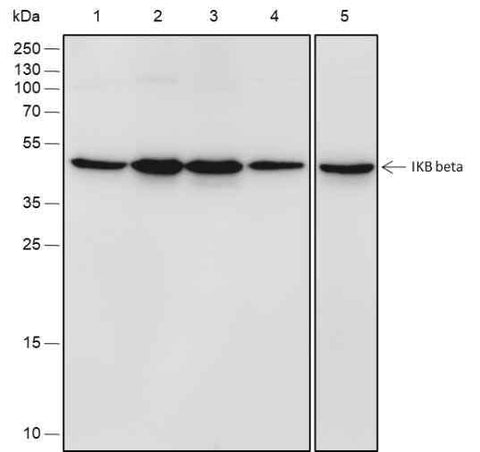 Anti-Human/Mouse IKB beta Antibody [A563] - ABMIUM
