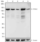 Anti-Human/Rat/Mouse PTPN12 Antibody [A502]