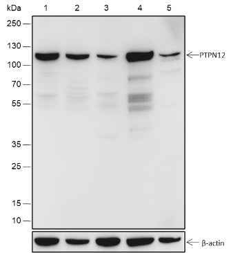Anti-Human/Rat/Mouse PTPN12 Antibody [A502]
