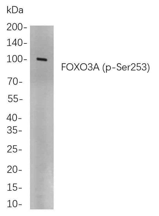 Anti-Human/Mouse/Rat FoxO3A Antibody [B762] - ABMIUM