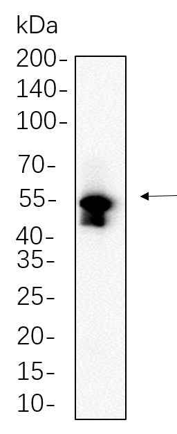 Anti-Human/Mouse/Rat/Chicken MLKL Antibody [B655] - ABMIUM