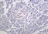 Anti-Human/Mouse/Rat Islet-1 Antibody [B1056]
