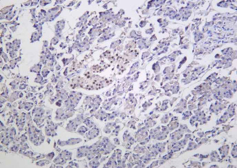 Anti-Human/Mouse/Rat Islet-1 Antibody [B1056] - ABMIUM