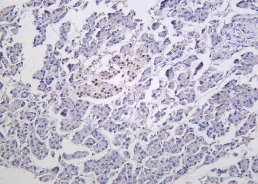 Anti-Human/Mouse/Rat Islet-1 Antibody [B1056] - ABMIUM