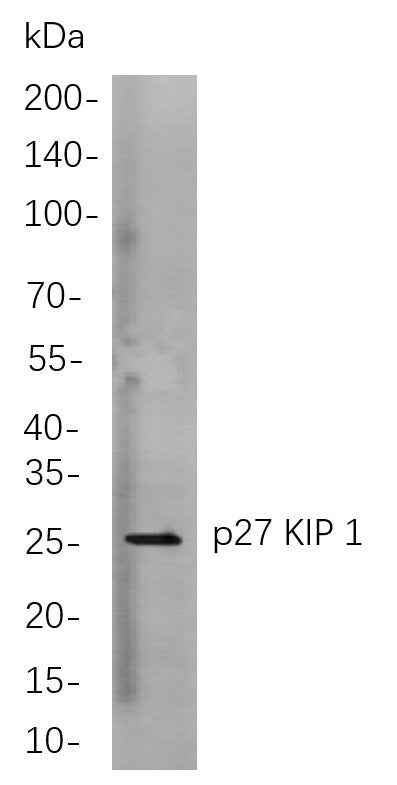 Anti-Human/Mouse/Rat p27 KIP 1 Antibody [B772] - ABMIUM